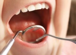 Treating Gummy Smile with Botox: What You Need to Know Gummy smile treatment