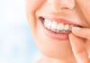 Invisalign braces cost in UK