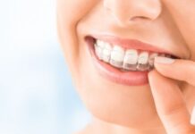 Invisalign braces cost in UK