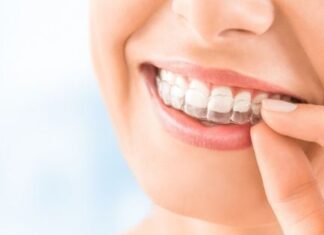 A Rough Estimation of The Cost of Invisalign and Other Braces Invisalign braces cost in UK