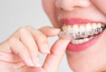 London-based Invisalign provider