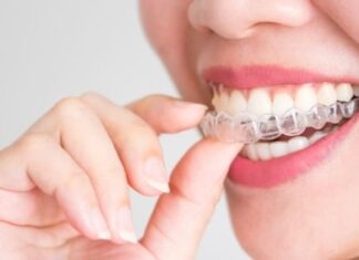 Does Invisalign Change The Facial Structure? London-based Invisalign provider