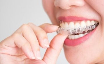 Does Invisalign Change The Facial Structure? London-based Invisalign provider