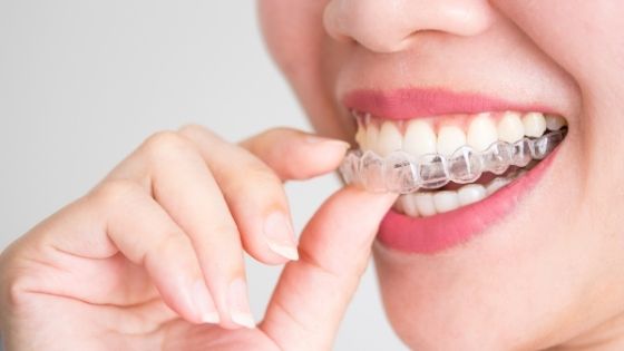 London-based Invisalign provider