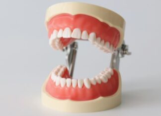 Why Are Straight Teeth Important? Why Are Straight Teeth Important