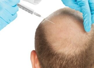 What You Should Know About a Hair Transplant? sapphire hair clinic in Istanbul
