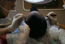 turkey hair transplant package