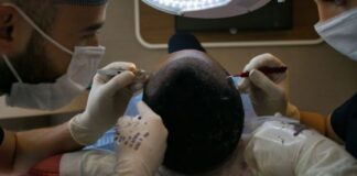 turkey hair transplant package