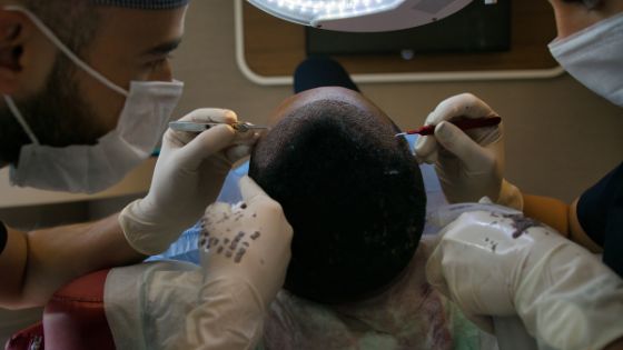 turkey hair transplant package