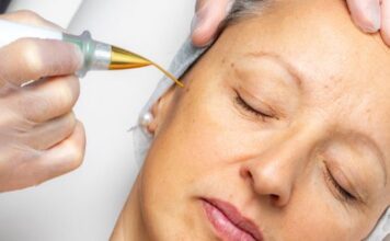 What Makes Fibroblast Plasma Skin Tightening so Popular? Fibroblast Plasma Skin Tightening