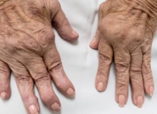 Can Regenerative Medicine Help You Get Rid of Arthritis? Can Regenerative Medicine Help You Get Rid of Arthritis