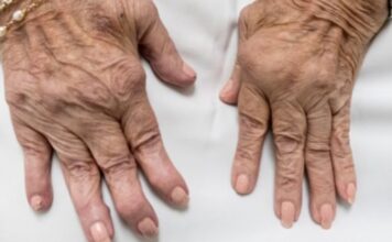 Can Regenerative Medicine Help You Get Rid of Arthritis? Can Regenerative Medicine Help You Get Rid of Arthritis