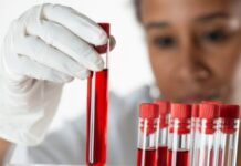 What Can Blood Tests Say About Your Health In The Future