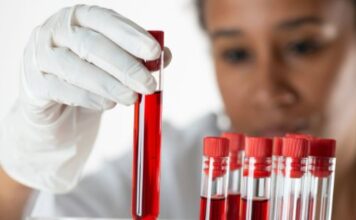 What Can Blood Tests Say About Your Health In The Future? What Can Blood Tests Say About Your Health In The Future