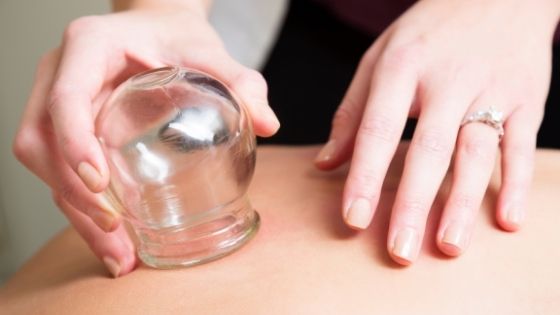 cupping therapy