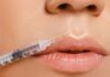 professional lip fillers clinic