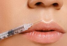 professional lip fillers clinic