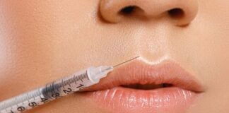 professional lip fillers clinic