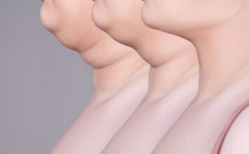 Loose Skin Under Chin – Exercise Loose Skin Under Chin – Exercise