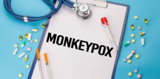 Monkeypox in Africa