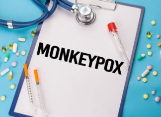 Monkeypox in Africa