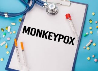 Monkeypox in Africa Monkeypox in Africa