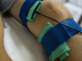 ACL Ligament Surgery in Rajasthan