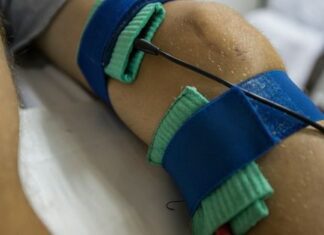 A Brief Guide about ACL Ligament Surgery in Rajasthan ACL Ligament Surgery in Rajasthan