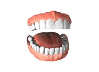 Tooth Bonding – What is it, and Who is it for? Tooth Bonding